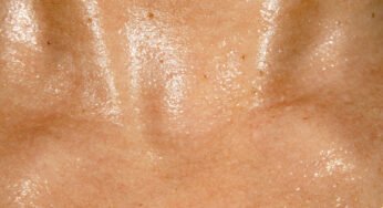 What Could Sweat-Sensing Devices Tell You about Your Health?